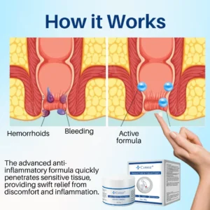 🌟 Official Store |🔥Hot Sale - 50% OFF🌿Cvreoz® Hemorrhoid & Fissure Cream